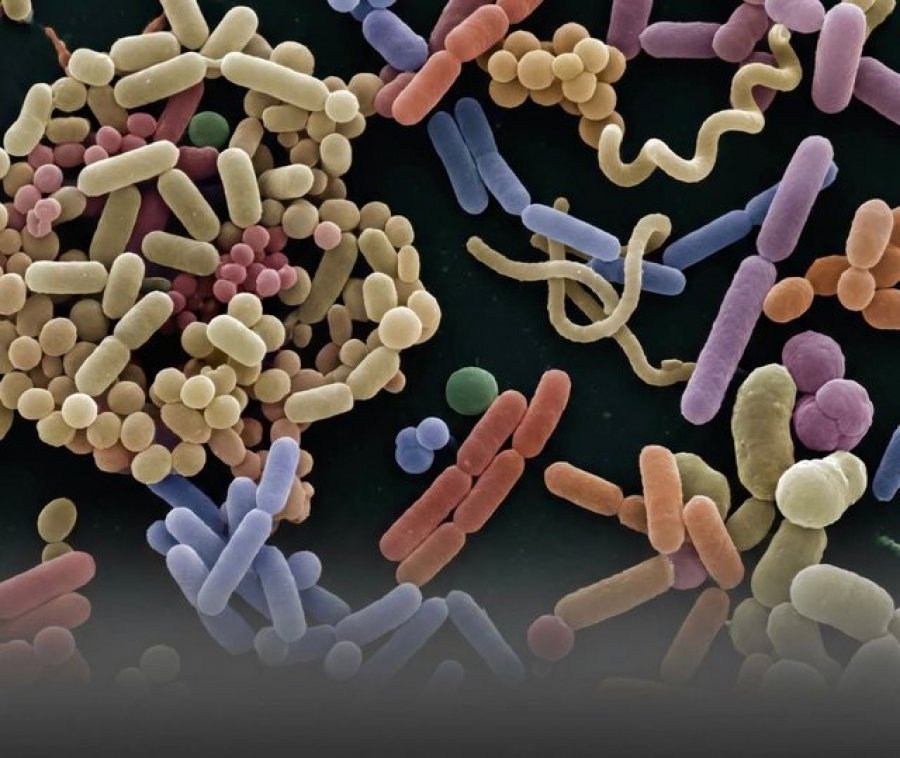 Shkencëtarët identifikojnë bakterin pas endometriozës  duke hapur shpresë që antibiotikët mund ta kurojnë